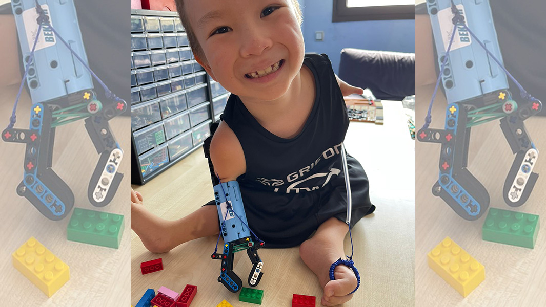 lego prosthetic arm split image of david aguilar and child he built prosthesis for