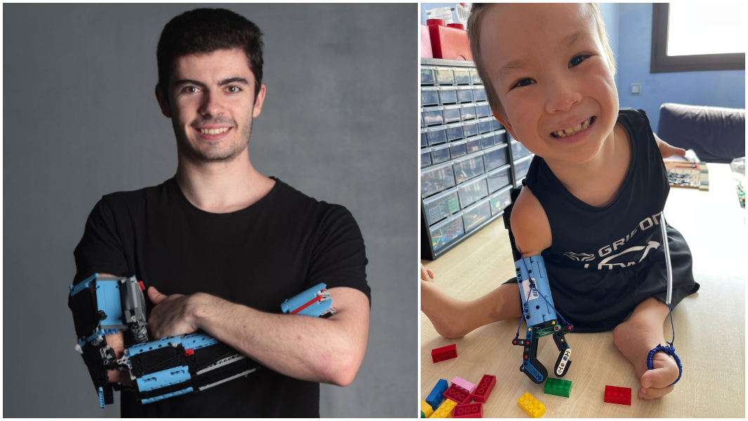 lego prosthetic arm split image of david aguilar and child he built prosthesis for