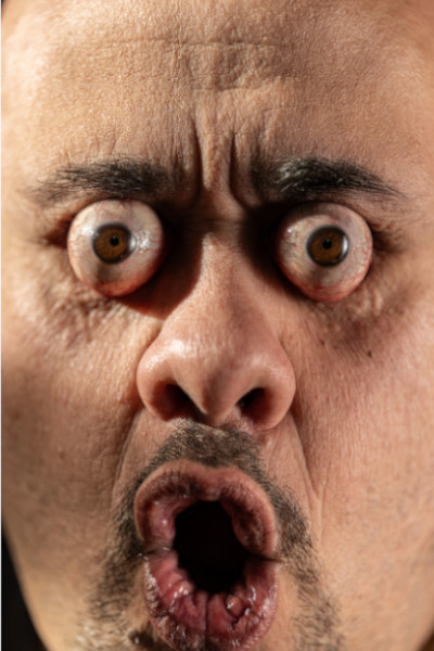 William popping eyes with open mouth