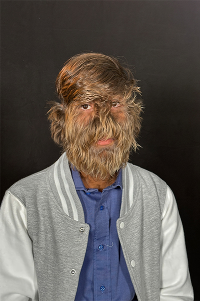 hairiest face on a man